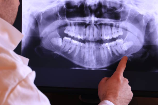 Best Emergency Treatment for Jaw Pain or Injury in Oran, MO